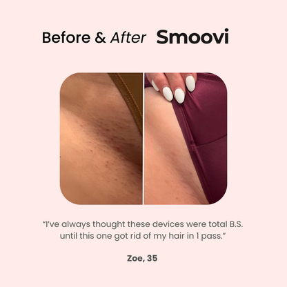 Smoovi 2.0 Bikini Shaver