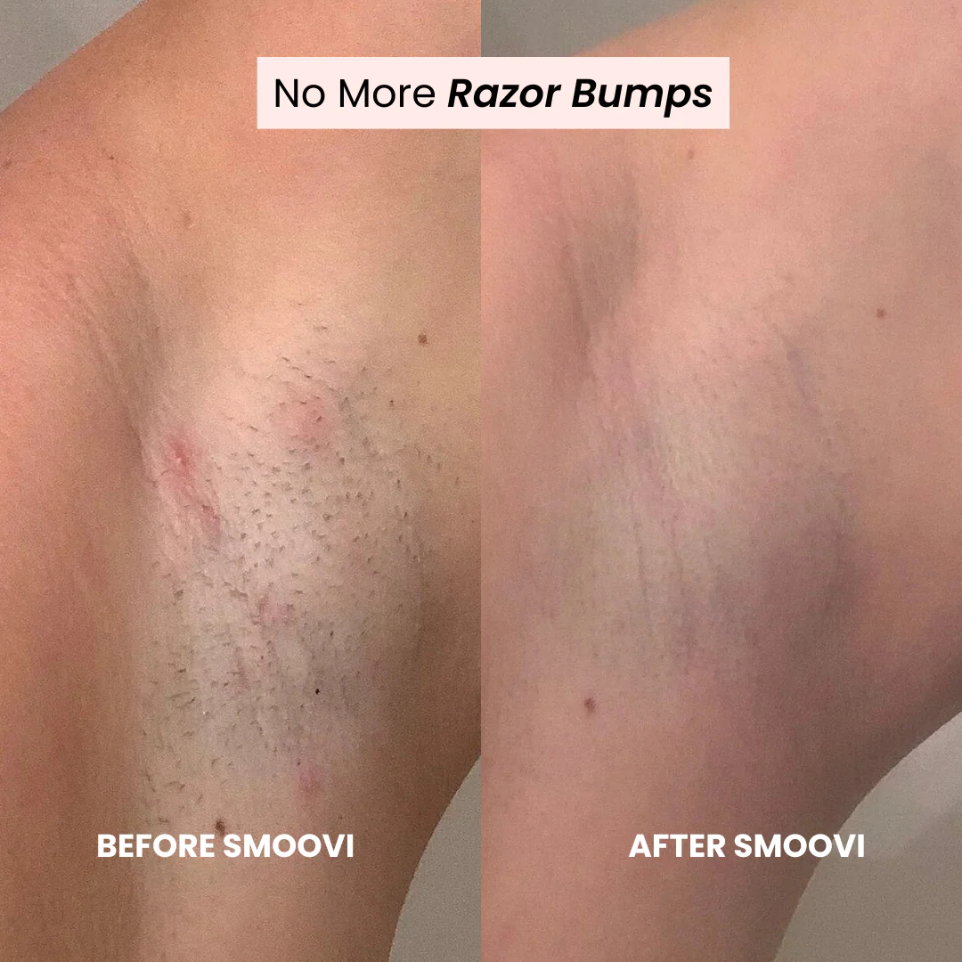 Smoovi 2.0 Bikini Shaver