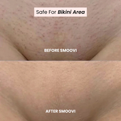 Smoovi 2.0 Bikini Shaver