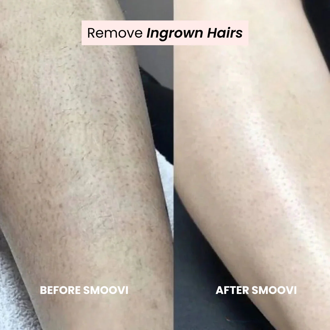 Smoovi 2.0 Bikini Shaver